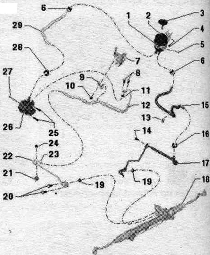 1. Превръзка.
